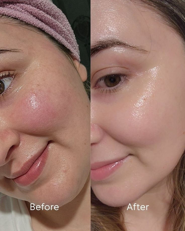 Glycolic Acid 7% Toning Solution